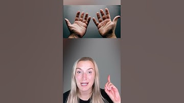 RARE Human MUTATIONS That ACTUALLY Exist!😱