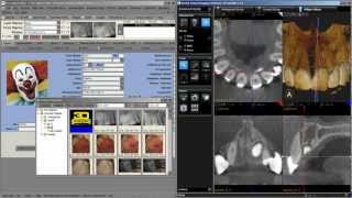 Using TDO in a split screen while manipulating CBCT scans, October, 2012