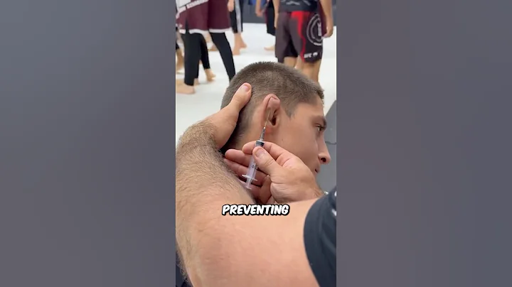 Why Fighters Get Their EARS Drained… #xs28