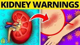 ⚠️10 Early Signs Your Kidneys Are Toxic