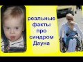 Видео о синдроме дауна 2016 год видео thumbnail