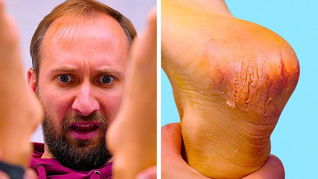LIFE-SAVING BEAUTY HACKS EVERY GIRL SHOULD KNOW || BEFORE AND AFTER - YouTube