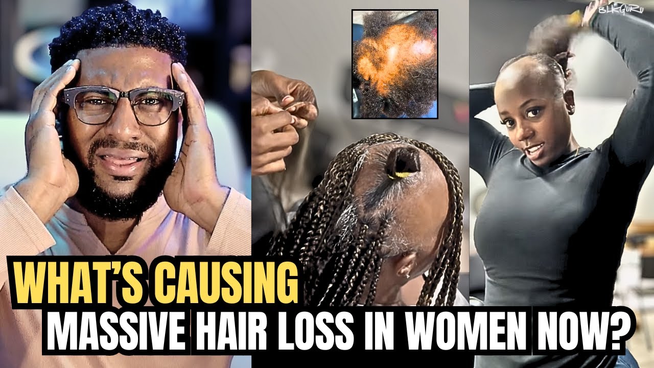Что является причиной МАССОВОЙ потери волос у женщин в настоящее время?
