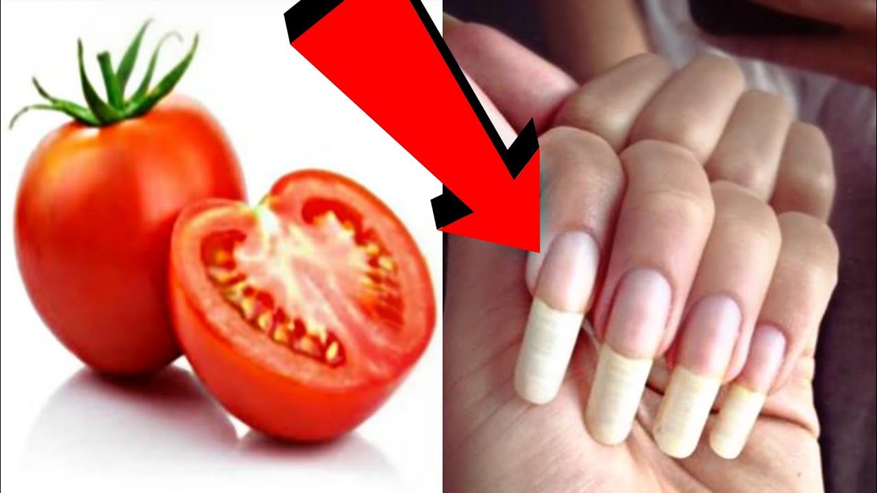 नाखून बढ़ाने के आसान और कारगर घरेलू नुस्खे Grow Your Nails Naturally Home  Remedies - YouTube