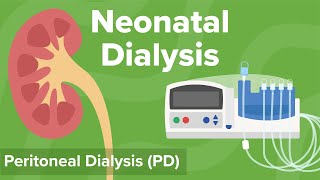 Neonatal Dialysis: Peritoneal Dialysis | Cincinnati Children's