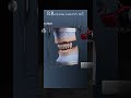 Its RR Dental lab- best dental lab in India