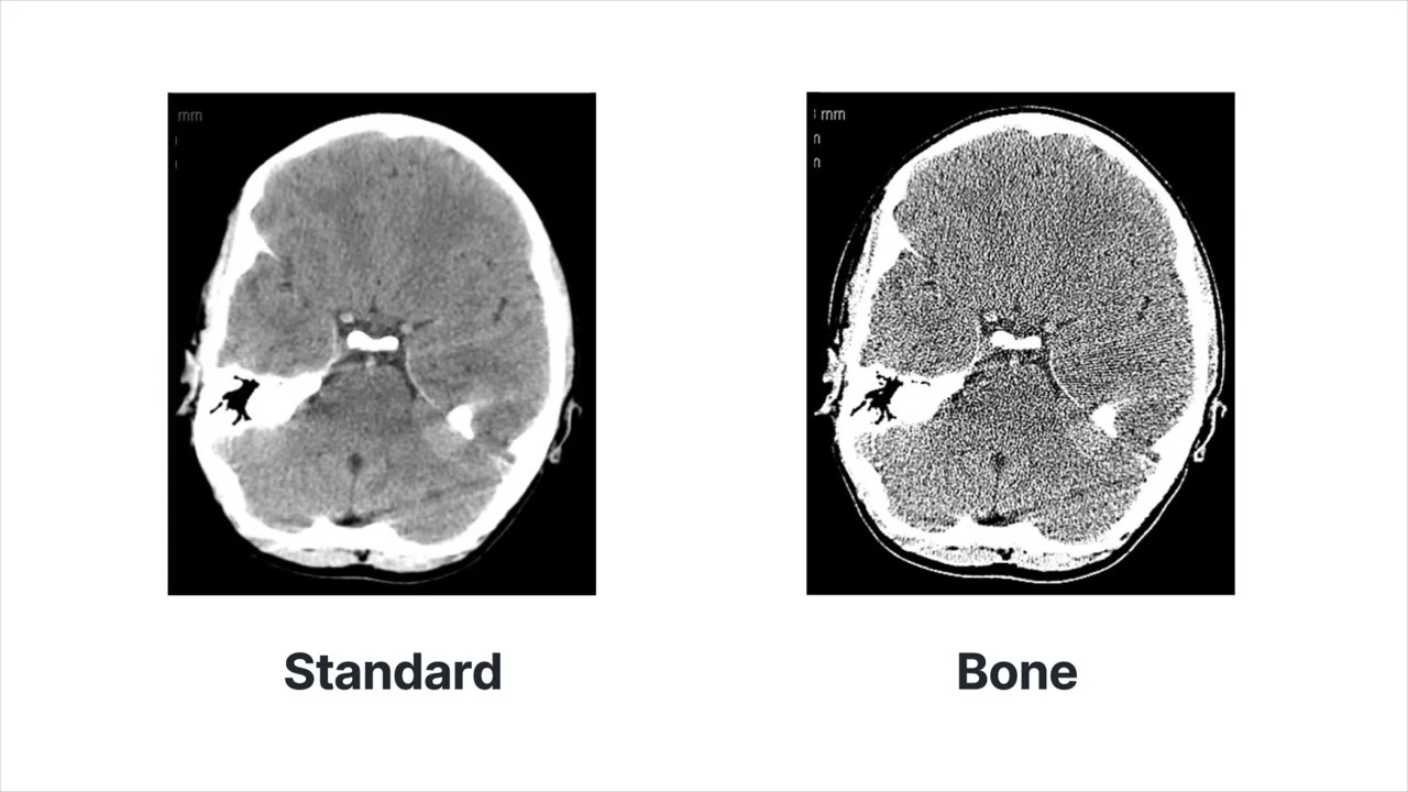 Что происходит в процессе реконструкции для создания КТ-изображения?: Физика КТ