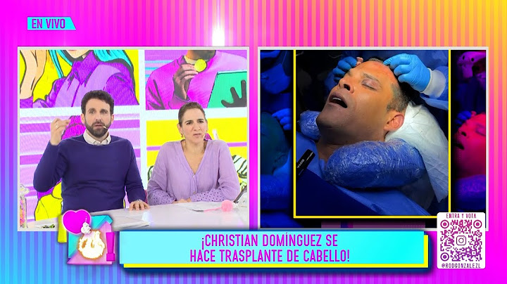 Amor y Fuego - JUL 03 - 2/4 - CHRISTIAN DOMÍNGUEZ SE HACE TRASPLANTE DE CABELLO | Willax