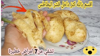 اقسم بالله كنز داخل قشر البطاطس ويشفي من7 امراض خطيرة جدا/ضاع عمرنا واحنا بنرميه مش هتخطر علي بالك