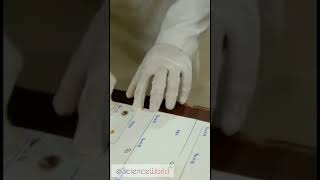 Determination of the blood groups 🩸💉 #Practicals #ScienceWorld screenshot 3