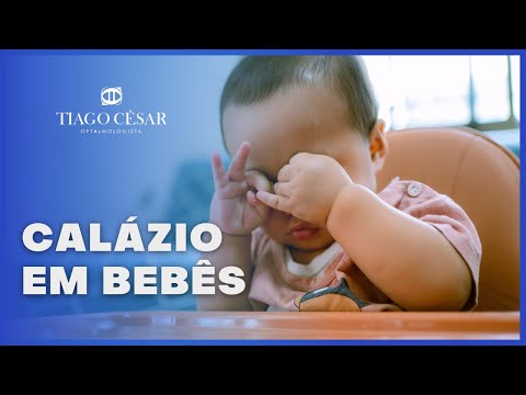 Calázio - Dra. Marcela Zantut - Oftalmologia Infantil