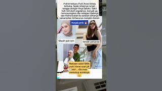 Putri Anne berubh Krn pisah sma Arya saloka 😢#putrianne #shorts #viralshorts