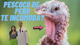 Como acabar com a papada e o pescoço de peru? 