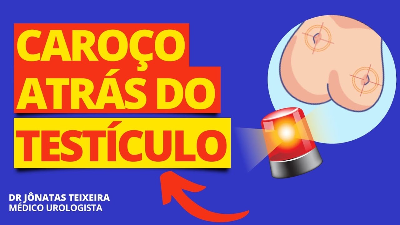 CAROÇO atrás do TESTÍCULO! O que PODE SER? - YouTube