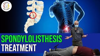 Spondylolisthesis Treatment