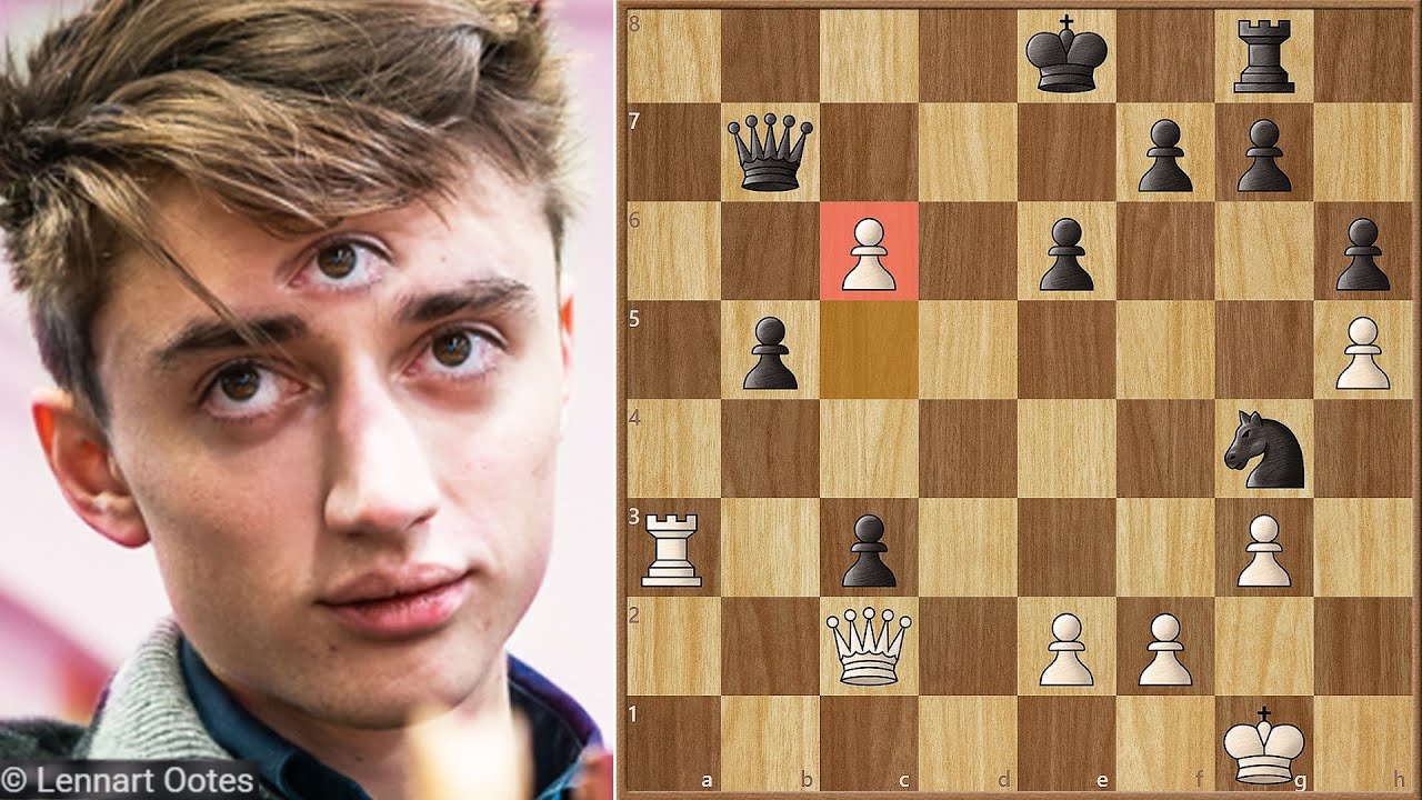 Daniil Dubov Mouse Slips And Loses the Game 