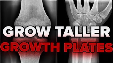 How to Know If Your Growth Plates Are Open at Any Age (Without An X-Ray)