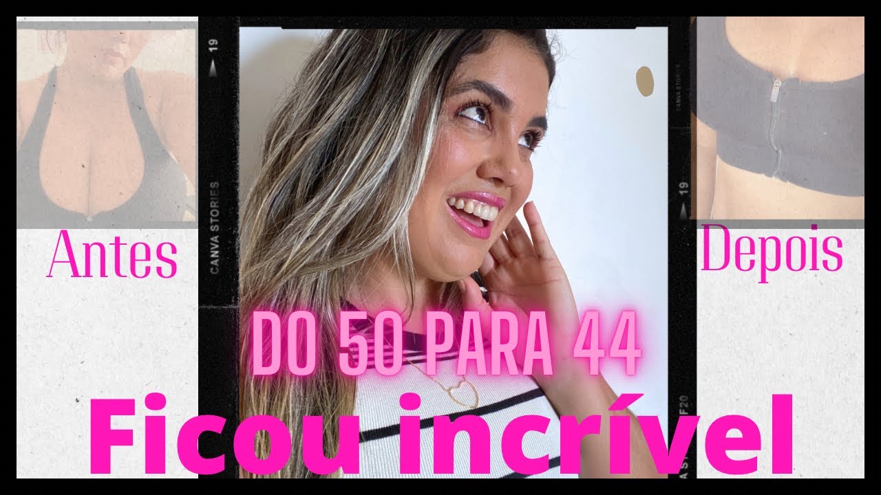 Como eu era antes e depois da mamoplastia redutora - YouTube