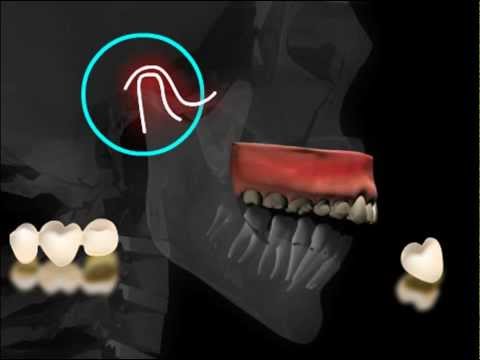 Video: Evoluzione Adattativa Della Dentatura Della Mascella Inferiore Nel Tetra Messicano (Astyanax Mexicanus)