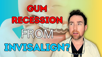 Dentist Explains: Does Invisalign REALLY cause Gum Recession?