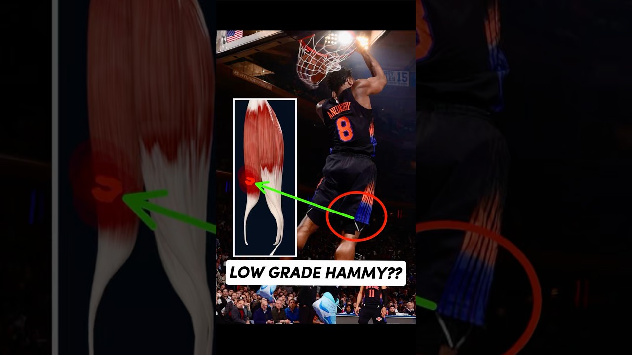 DOCTOR Explains OG Anunoby’s Hamstring Injury Biomechanics #Knicks