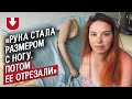 Мне отрезали руку: Влада | Вопреки