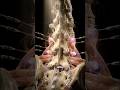 Why Doctors Do a Temporary Block Before Lasting Nerve Ablation #newyork #painmanagement