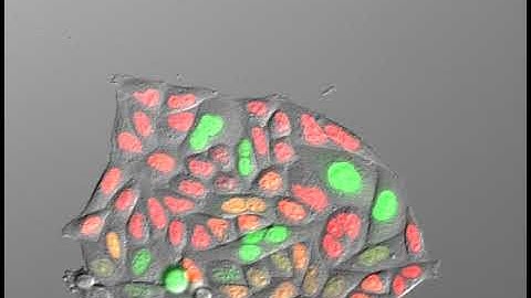 HeLa cell ― Cell cycle indicator Fucci
