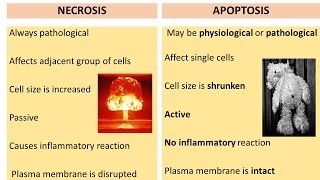 APOPTOSIS PART 2: Necrosis Vs Apoptosis, Diagnosis. Necroptosis, Pyroptosis.