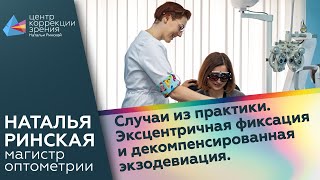 Случаи из практики. Эксцентричная фиксация и декомпенсированная экзодевиация.