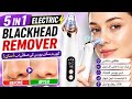5 in 1 Blackhead Remover Machine | Deep Pore Cleaner & Acne Remover
