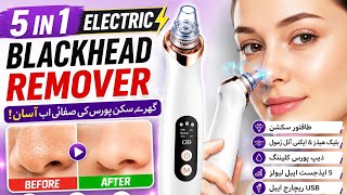 5 in 1 Blackhead Remover Machine | Deep Pore Cleaner &amp; Acne Remover