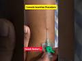 Cannula Insertion Procedure / 18 Cannula kaisa rhta hai / Nursing Study / Vlog #doctor #shorts