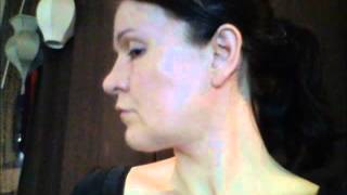 Day 13 post surgery "Dr. Lay Lift" Slim Lipo and Fat Grafts
