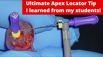 Root Canal Procedure - Ultimate Apex Locator Tip