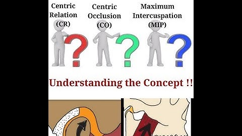Understanding the Concept of Centric Relation/ Centric Occlusion/ Maximum Intercuspation