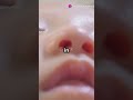 Newborns: Born with Over 300 Bones!