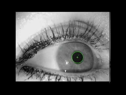 16. Real-time pupil detection on ExCuSe XVI