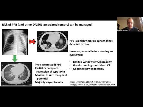 Video: Yuav Npaj Li Cas Thyroid Scan: 14 Kauj Ruam (nrog Duab)