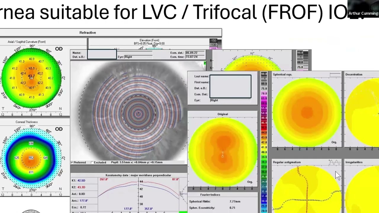 Patient Selection for Advanced Technology IOLs