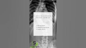 3 key schroth principles! Join the Schroth Boss Community! Schrothboss.com