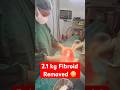 😳 22-Year-Old with 2.1 KG Fibroid! Massive Fibroid Removed ✅ #shorts #shortvideo
