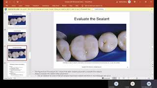Ch 59 Sealants