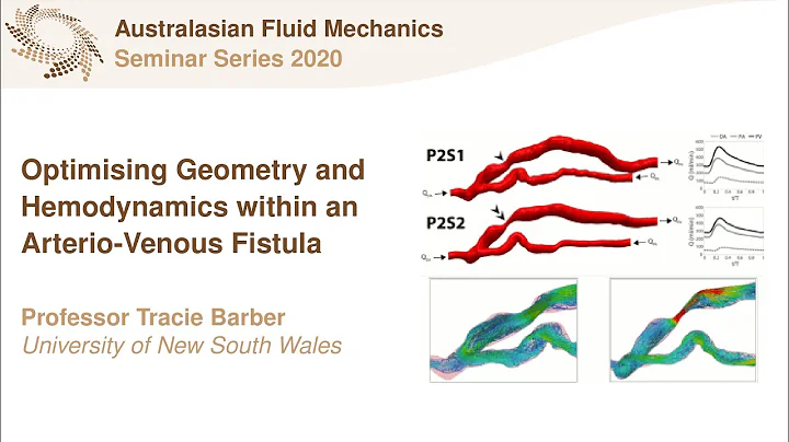 AFMS Webinar 2020 #6 - Professor Tracie Barber (Un...