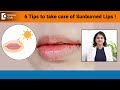 6 AMAZING Tips to take care of Sunburned Lips | Lip Care Tips - Dr Amee Daxini | Doctors&#39; Circle