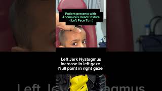 Left Jerk Nystagmus with Null point in Right Gaze