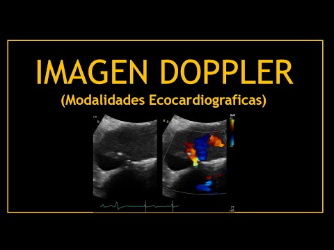 Vídeo: Què significa Doppler en termes mèdics?
