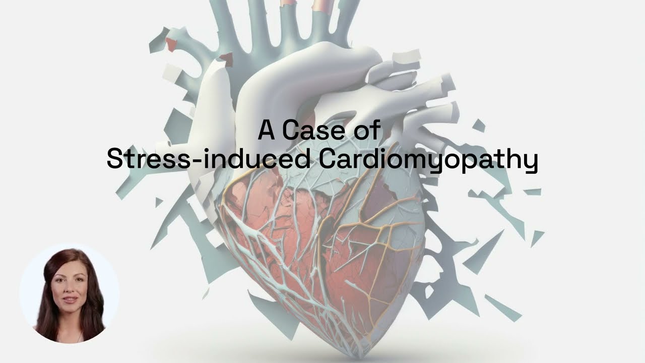 A Case Study Of Stress induced Cardiomyopathy Or Takotsubo A Case Study Of Stress induced Cardiomyopathy Or Takotsubo
