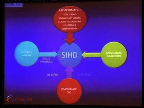 STABLE ISCHEMIC HEART DISEASE- HOW IS IT DIFFERENT FROM ACS - YouTube