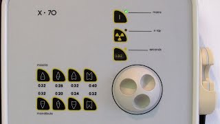 Irmer - Optimisation Operator Technique. L9